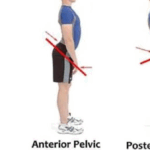 “자세 교정, 눈에 보이는 것보다 중요한 이유”