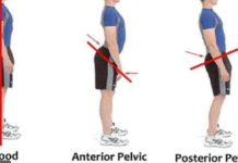 “자세 교정, 눈에 보이는 것보다 중요한 이유”