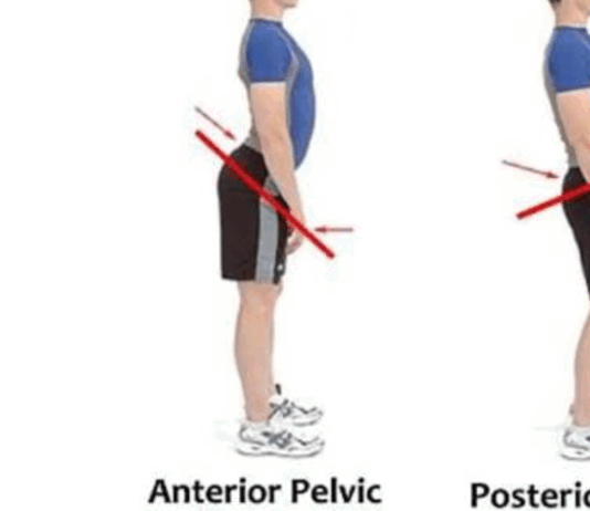 “자세 교정, 눈에 보이는 것보다 중요한 이유”